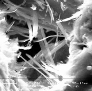 SEM image of pore-bridging authigenic illite straps and filaments, which were radiometrically dated by K-Ar to constrain the timing of oil charging