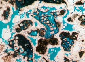 Petrography of carbonate with patchy Interparticle porosity lined by early isopachous freshwater calcite cements with a later generation of coarser calcite. Late selective leaching of High Magnesium Calcite foraminifera is of inferred burial origin.