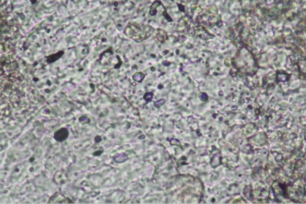 Two-phase fluid inclusions with highly variable liquid:vapour ratios including some methane gas inclusions , Lower Tertiary, Salt Range, Pakistan