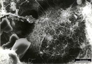 SEM image of partly collapsed diagenetic illite fibres, which bridge across pores in the reservoir and greatly reduce permeability. Illustrates how critical point drying is required to preserve fibres in reservoir position.