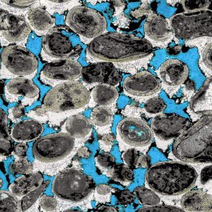 carbonate diagenesis microstalactitic vadose cements in ooid grainstone